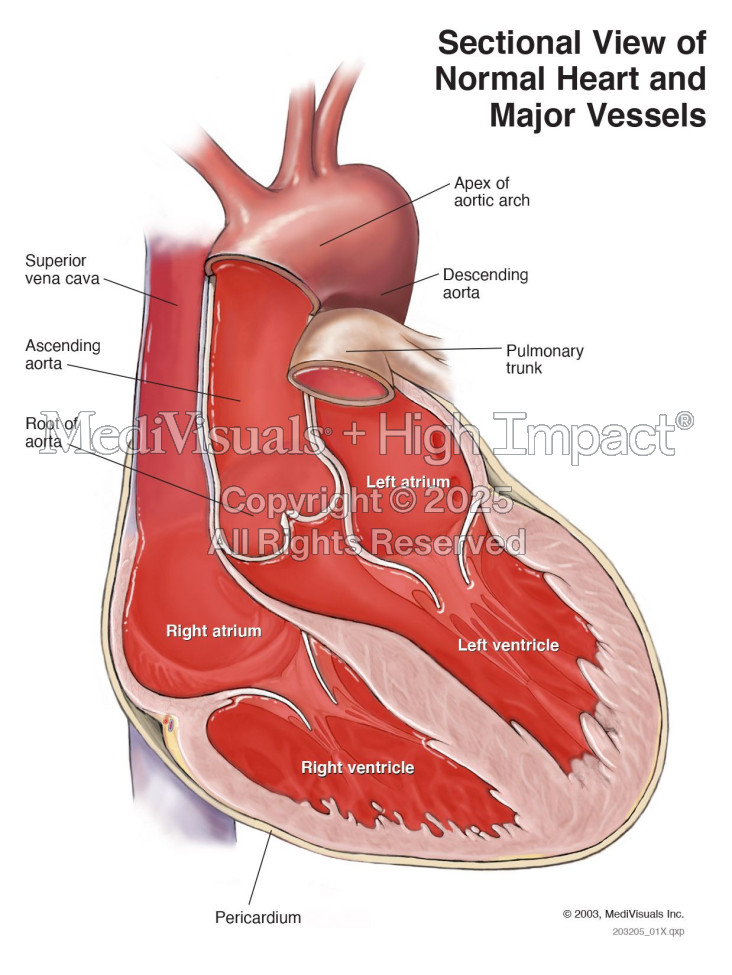 Sectional View of Normal Heart and Major Vessels