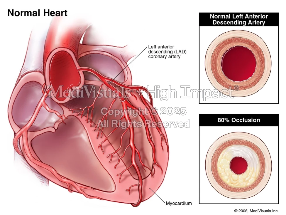 Normal Heart Report Normal Heart