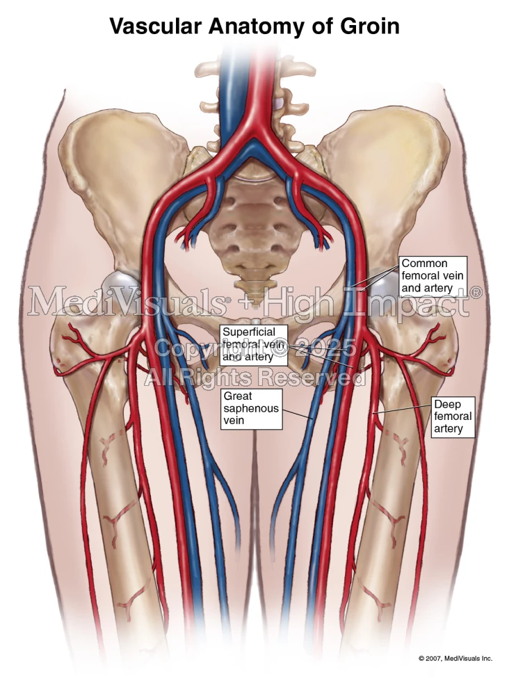 Sweating Groin Vascular Anatomy of Groin