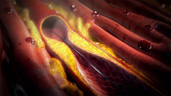 $21.3M Verdict Exposing KY Malpractice Monopoly at the Heart of Cardiologists’ Conspiracy