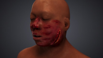 Summary of Facial and Head Injuries