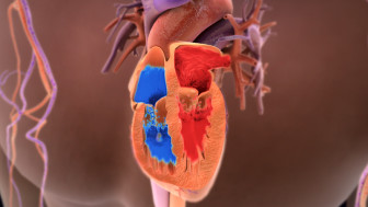 $8M Verdict: Animating Failure to Treat Heat Illness