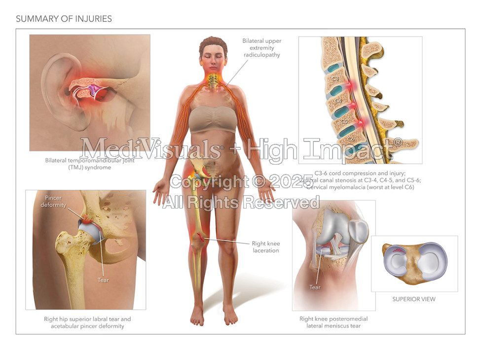 Innovative Ways Law Firms Use Trial Graphics & Illustrations