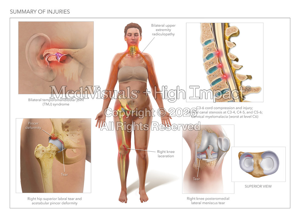 Innovative Ways Law Firms Use Trial Graphics & Illustrations