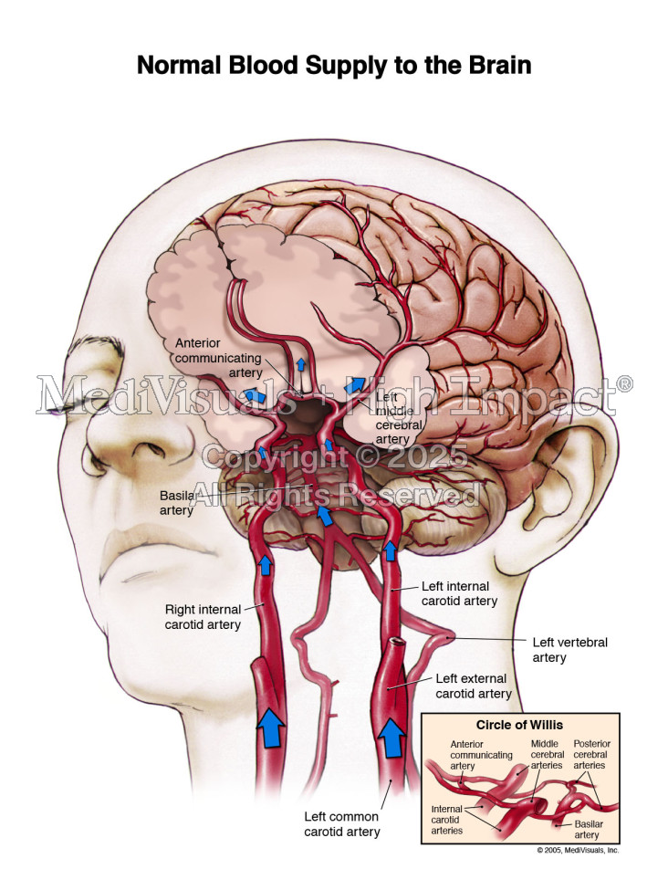 Normal Blood Supply to the Brain