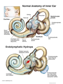 The Normal Anatomy of the Inner Ear | MediVisuals + High Impact
