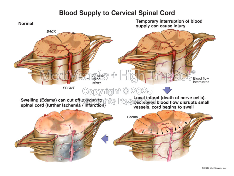 Blood Supply to Cervical Spinal Cord
