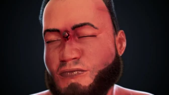 Summary of Gunshot Injuries