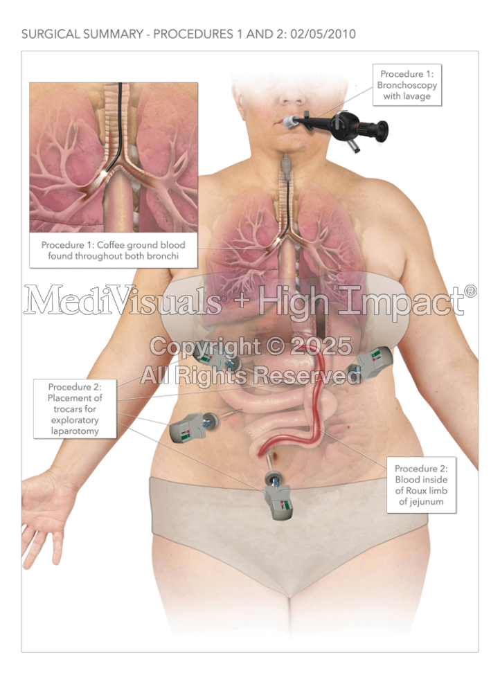 Abdominal Surgical Summary