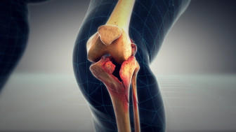 Mechanism of Leg Injuries