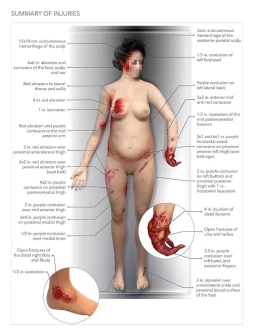 Summary of Injuries