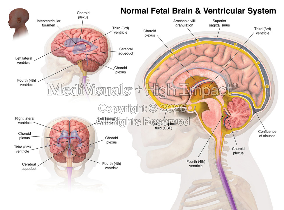 Medical Illustrations Help Secure $14 Million Verdict in Birth Injury Malpractice Case