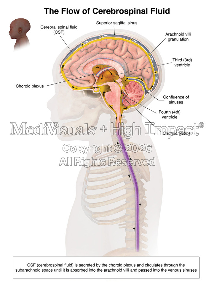 Medical Illustrations Help Secure $14 Million Verdict in Birth Injury Malpractice Case