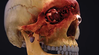 3D Animation Legal: Using Visual Evidence Strategically in High-Stakes Litigation