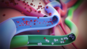 $6M Settlement: Animating Failure to Examine and Treat Malignant Melanoma