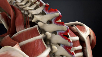 Cervical Ligamentous Injury