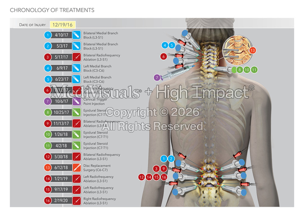The Best Ways to Show Your Client’s Spine Injury and Maximize Your Results