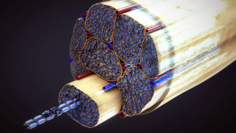 Complex Regional Pain Syndrome