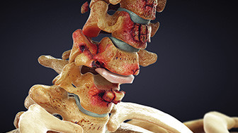 Trial Animation: Visual Strategies That Win High-Stakes Cases