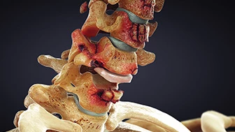 Trial Animation: Visual Strategies That Win High-Stakes Cases