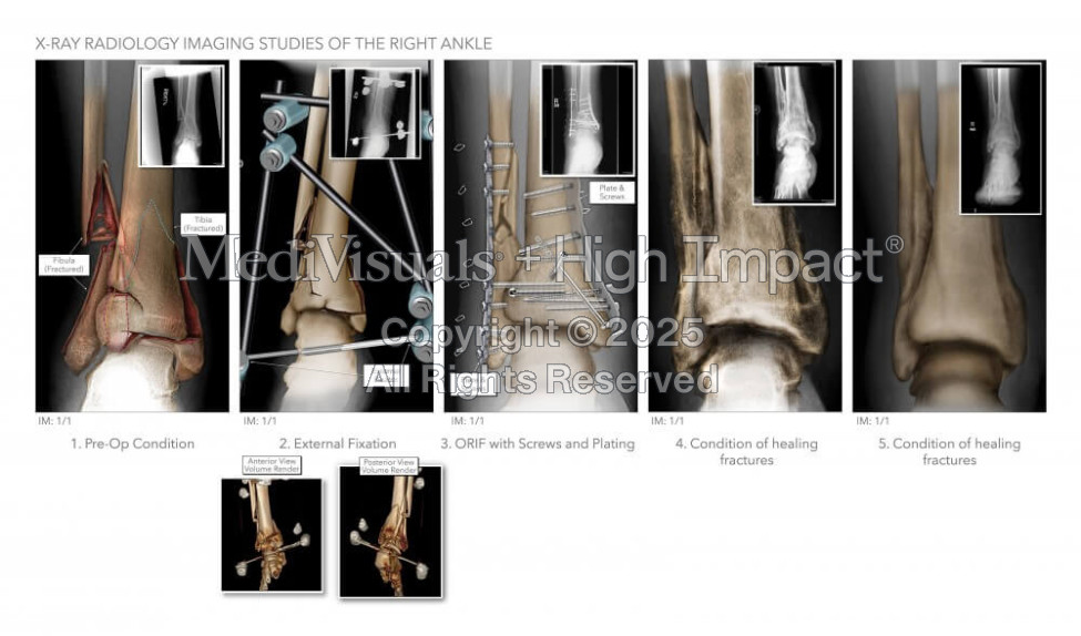 X-Ray Radiology Imaging Studies of the Right Ankle