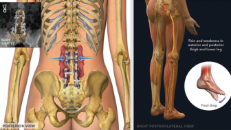 $3.8M Verdict: Medical Illustrations and Colorized Films Prove Liability