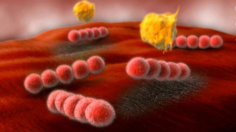 Necrotizing Fasciitis