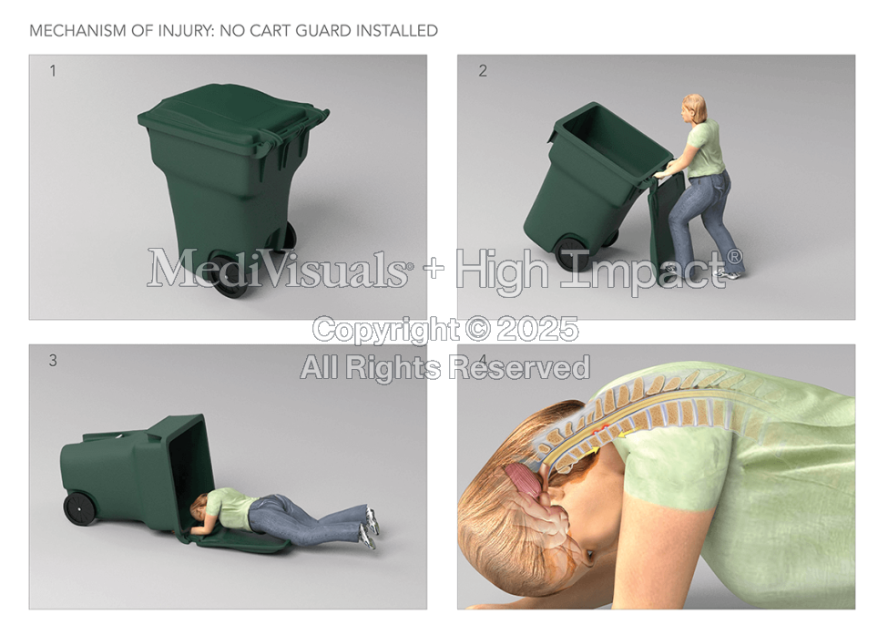 Mechanism of Neck Injury