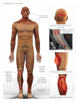 Summary of Injuries