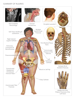 Summary of Injuries with Repair