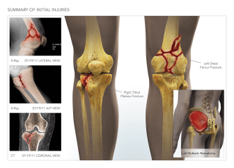Summary of Initial Injuries