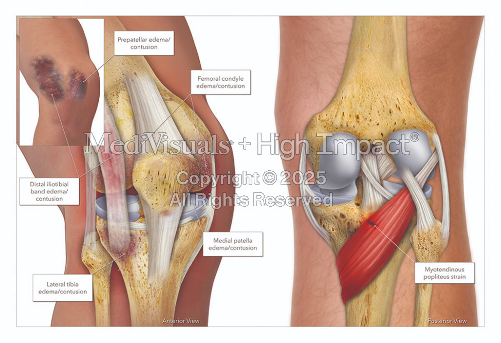 Hottman Law Office: An Exciting Partnership