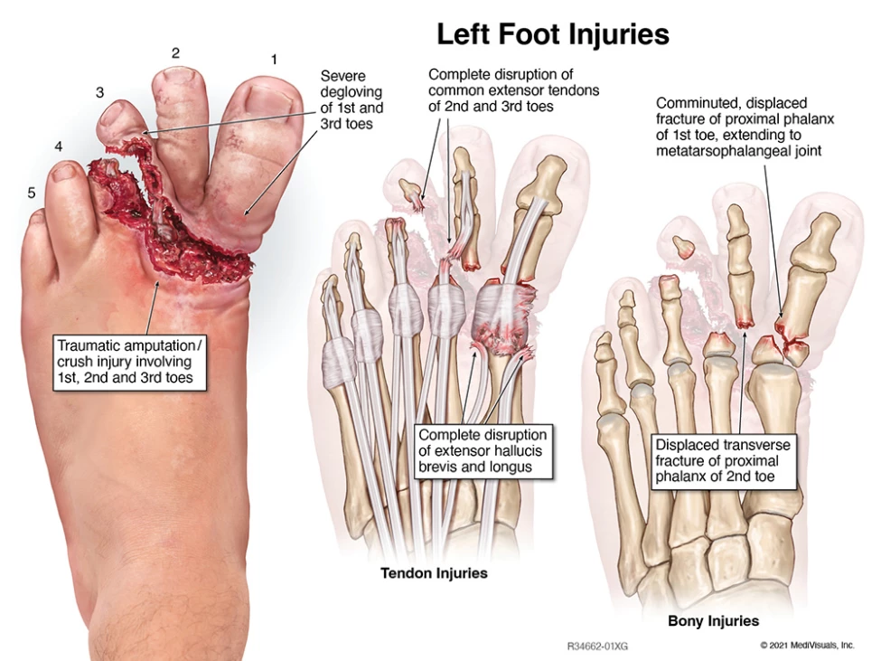 Legal Graphics: A Practical Guide to Medical-Legal Illustrations for Litigation