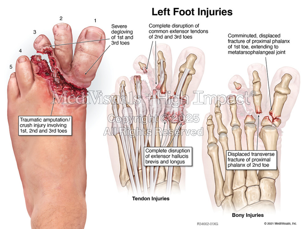 How High-Quality Medical Legal Illustrations Can Help Jurors to Understand Complex Concepts