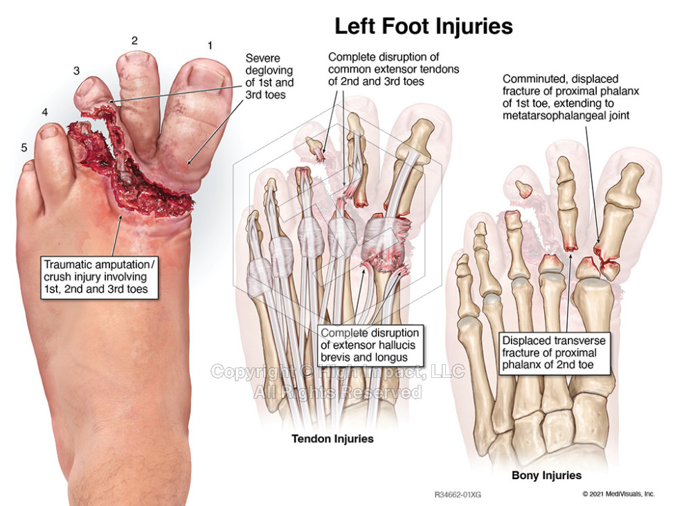 Medical Illustrations