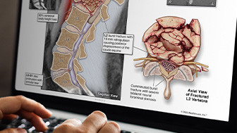 Medical Legal Illustration: Turning Complex Medicine Into Persuasive Evidence