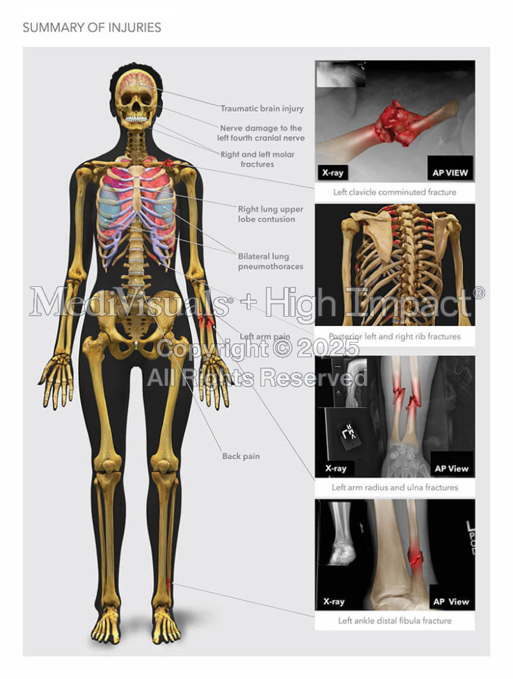 Summary of Injuries