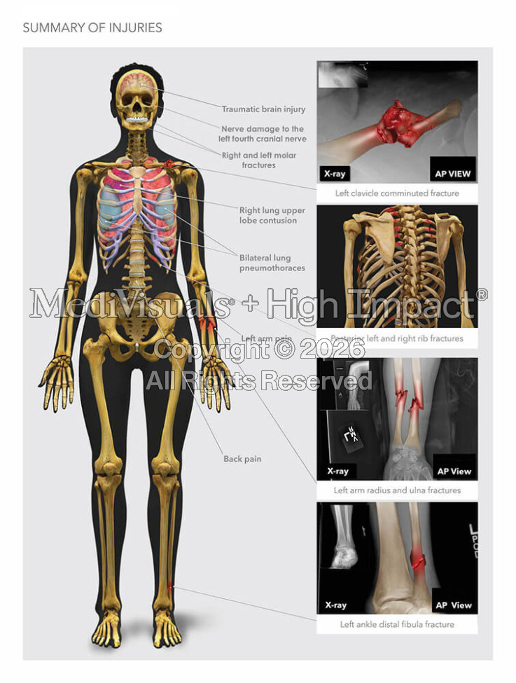 Summary of Injuries