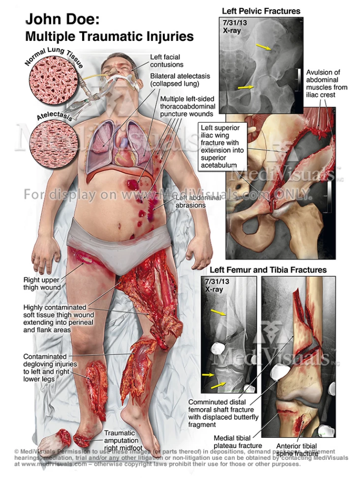 Demonstrative Exhibits: Using Visuals to Clarify Complex Evidence at Trial