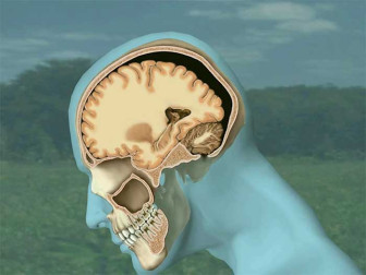 Mild Traumatic Brain Injury (TBI)