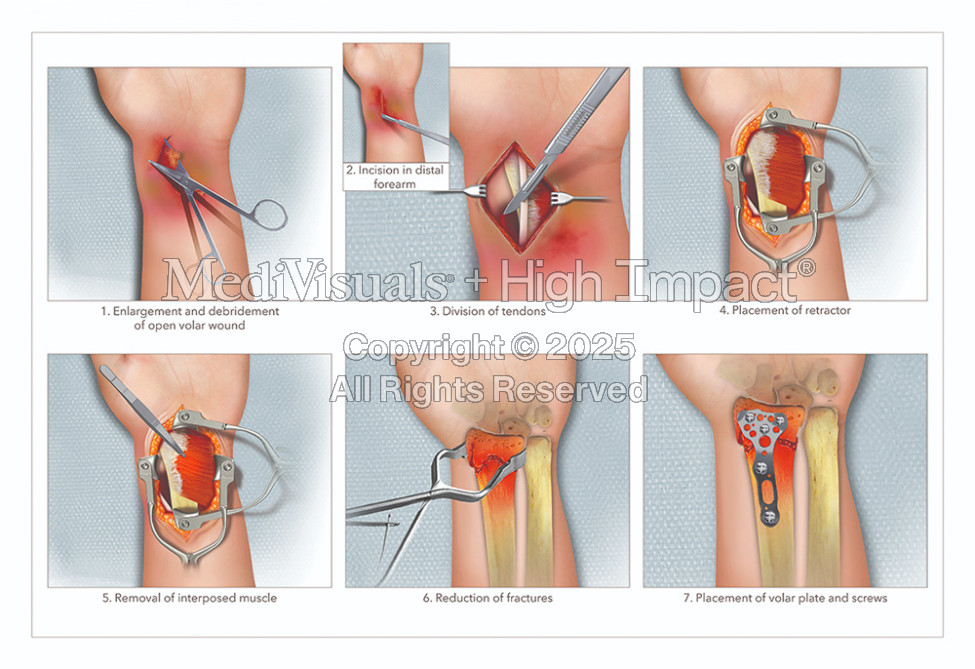 Hottman Law Office: An Exciting Partnership