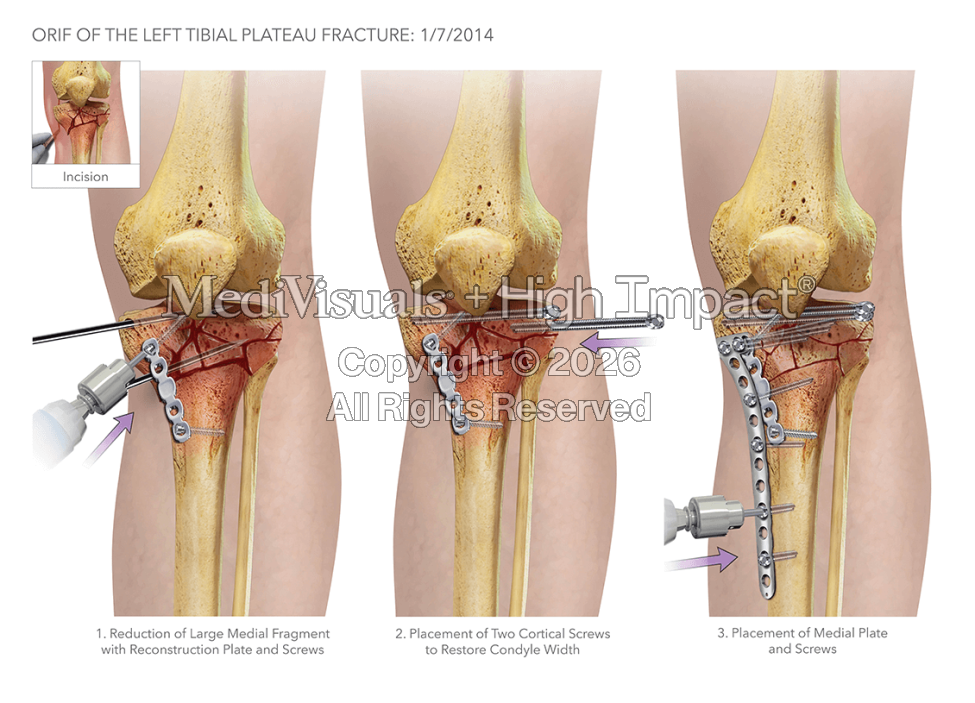 How Medical Legal Illustrations Aid Cases