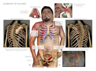 Pelvic and Residual Injuries