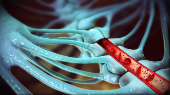 Effect on the Blood Brain Barrier