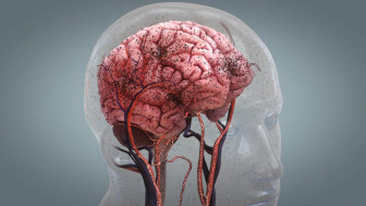 Decreased Cerebral Blood Flow