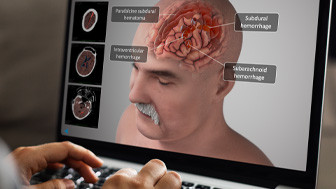 $18.97M Verdict: Trial Exhibits Explain the Extent of Fatal Injuries After Car Crash