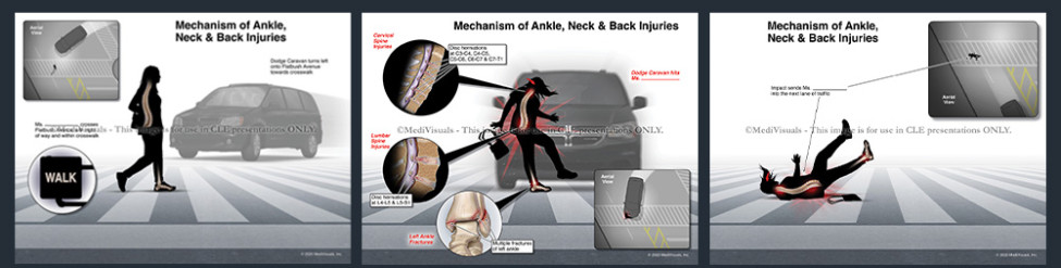 Motion Enhanced Visuals®