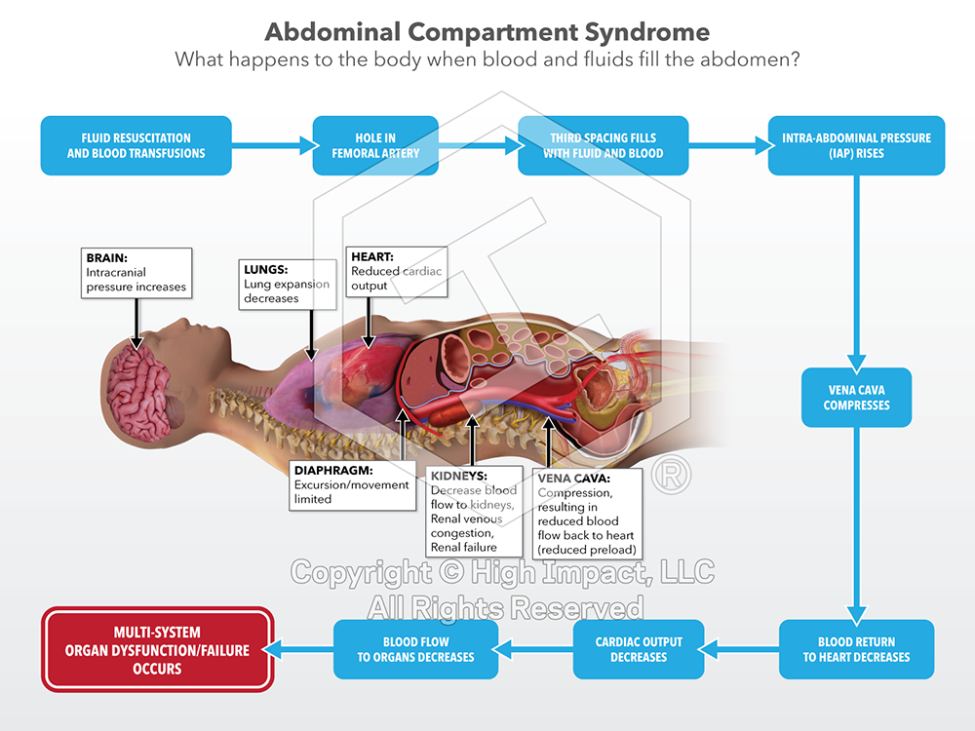 Showing Process and Change: How Timelines & Flowcharts Communicate Data