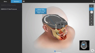 Severe Skull and Facial Injuries with Repair