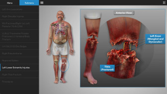 Digital Injury Summary